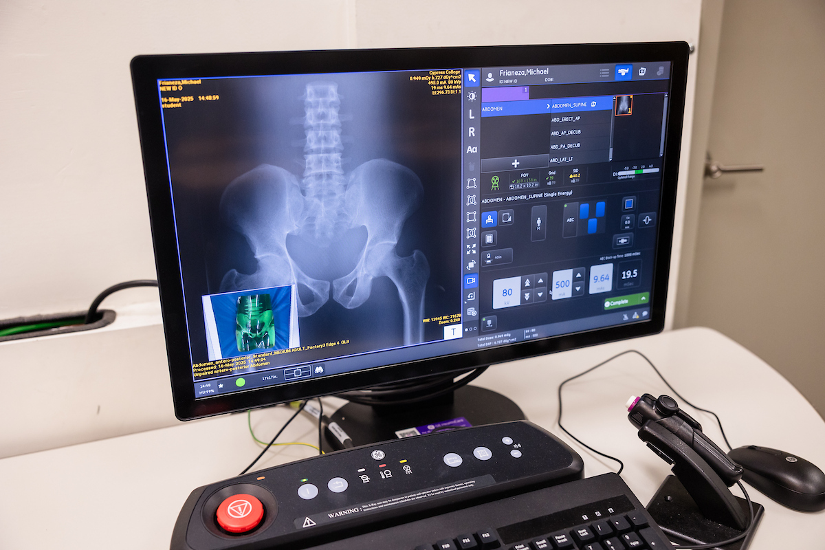 A monitor shows the imaging from a new radiograph